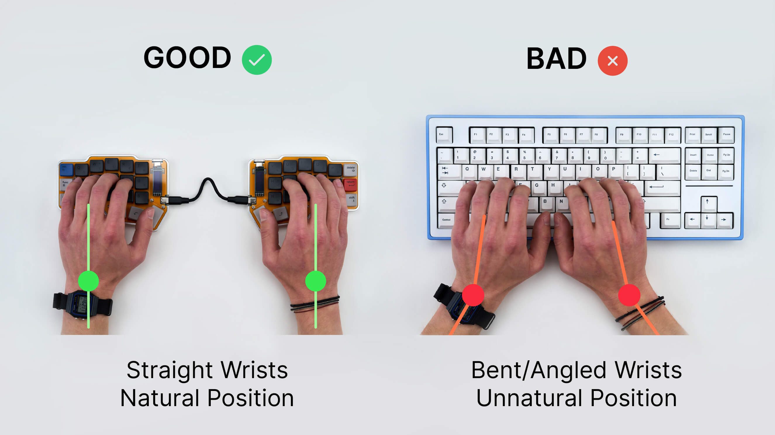 4 Reasons to Invest in a Ergonomic Split Keyboard
